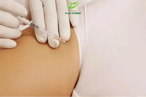 Kỹ thuật tiêm filler vùng kín an toàn, chính xác