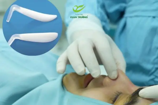 Bác sĩ thăm khám đánh giá dáng mũi trước khi thực hiện nâng mũi sụn nhân tạo