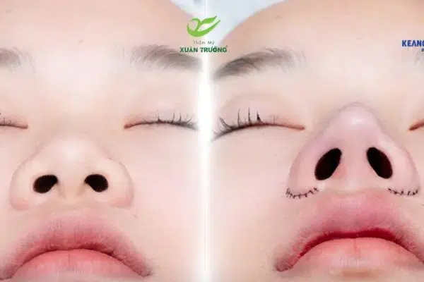 Hiệu ứng thon gọn giúp mũi trông cao và thanh tú hơn