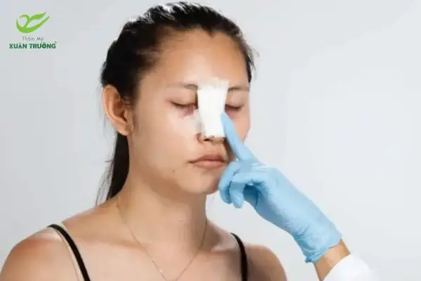 Chăm sóc đúng cách giúp mũi hồi phục nhanh và giữ form đẹp