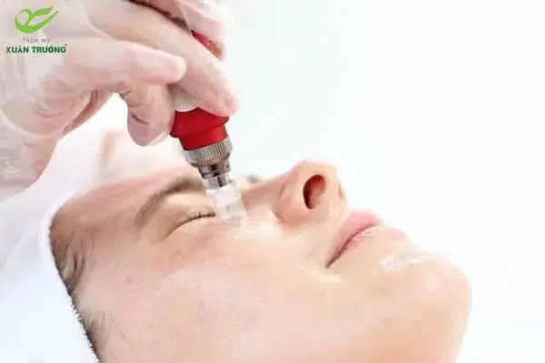 Hiệu quả cải thiện sắc tố sau liệu trình tế bào gốc trị nám