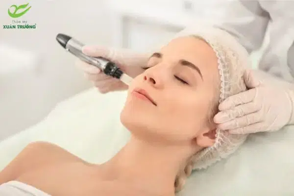 Phi kim tế bào gốc hỗ trợ cải thiện sắc tố da an toàn
