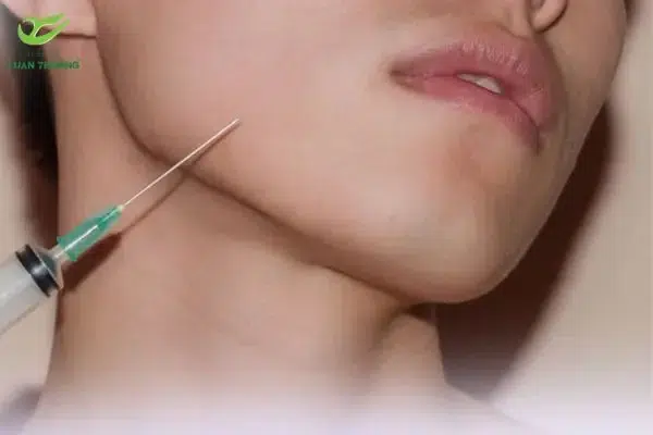Thời gian hồi phục sau tiêm botox gọn hàm an toàn là 24-48 giờ