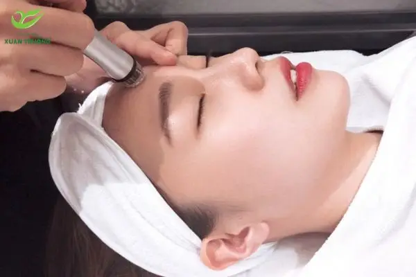 tiem botox gon ham kieng gi 3 Theo dõi và chăm sóc đúng giúp duy trì kết quả gọn hàm