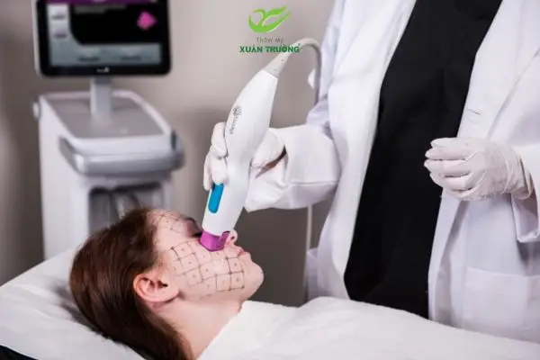Thermage FLX giúp săn chắc da, cải thiện nếp nhăn rõ rệt