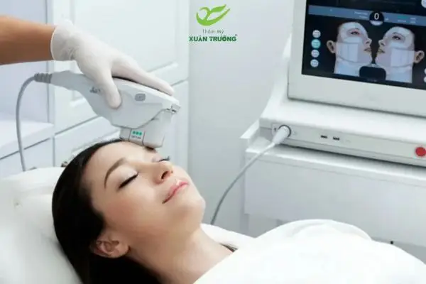 Ultherapy kích thích collagen tự nhiên, nâng cơ chuẩn FDA Hoa Kỳ