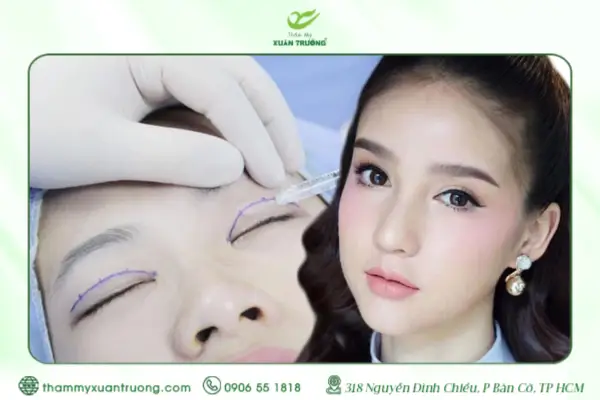 Cắt Mí Bao Lâu Thì Lành? Thời Gian Hồi Phục Và Cách Chăm Sóc