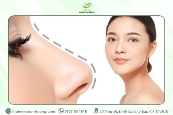 Nâng Mũi Bao Lâu Thì Sụn Bám Chắc Vào Form Tự Nhiên?