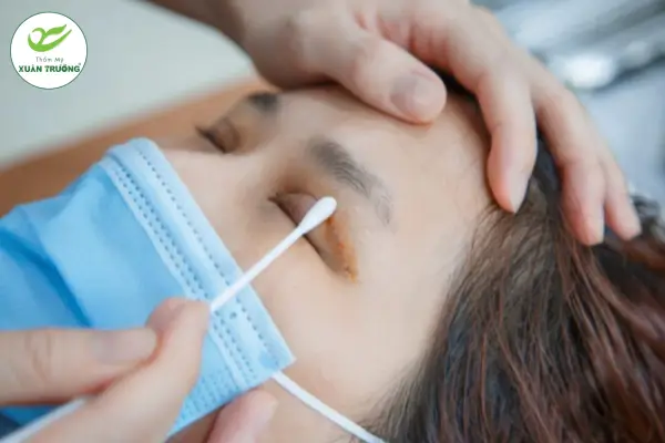 nhan mi bao nhieu tien 3 Chăm sóc đúng cách giúp nếp mí ổn định, đẹp tự nhiên lâu dài