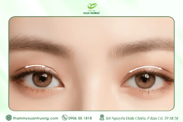 Nhấn Mí Bao Nhiêu Tiền: Chi Phí Và Những Điều Bạn Cần Biết