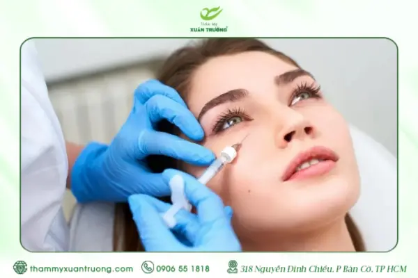 Giải Đáp Chi Tiết: Tiêm Filler Hốc Mắt Có An Toàn Không?