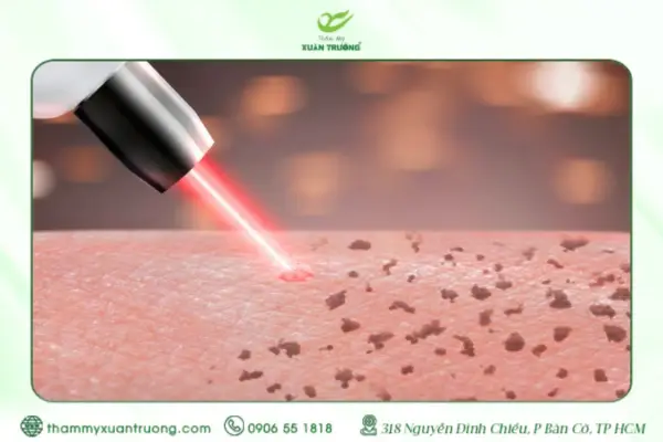 Bắn Tàn Nhang Kiêng Ăn Gì? Kiêng Bao Lâu Để Da Phục Hồi