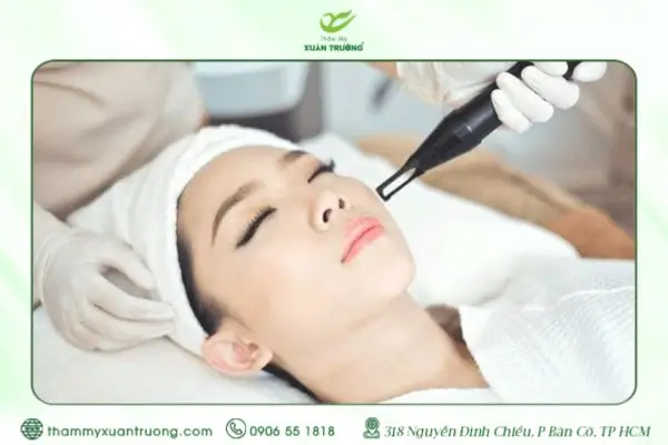 Cách Chăm Sóc Da Sau Khi Bắn Laser Trị Nám Chuẩn Y Khoa