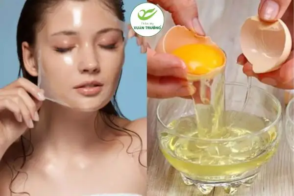 Cách trị nám bằng trứng gà hỗ trợ làm sáng da, mờ thâm tự nhiên