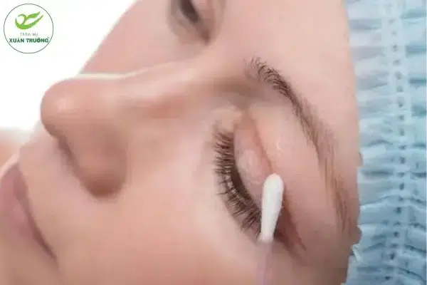 Chăm sóc đúng cách giúp mí nhanh giảm sưng, vào form tự nhiên